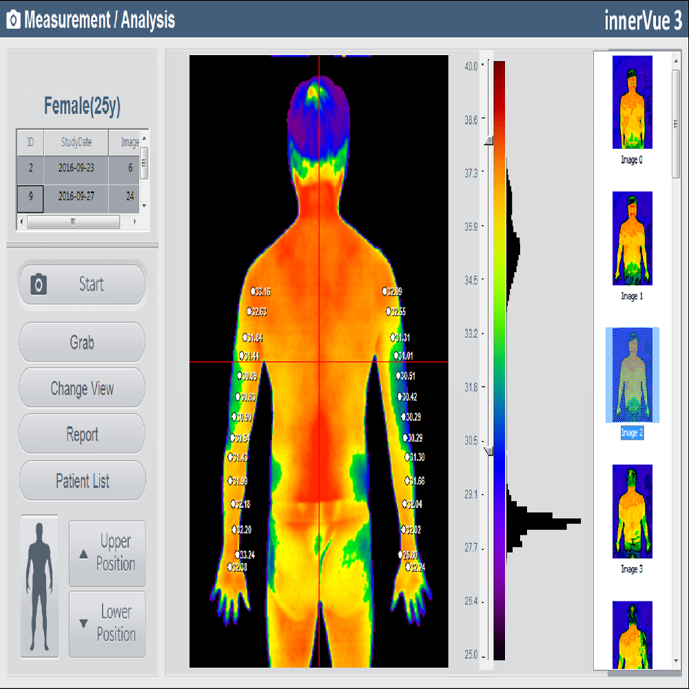 Digital Infrared Thermal Imaging System