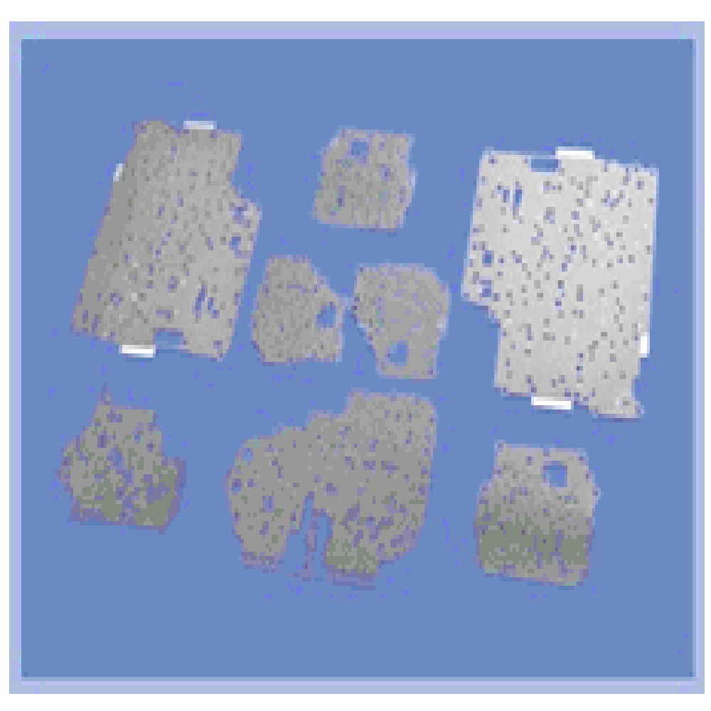 PSA for Automatic Transmission Valve Body