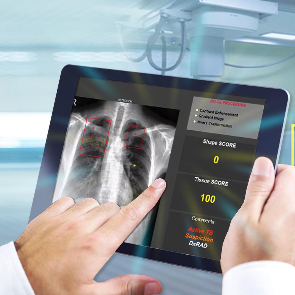 DxRAD (Digital X-ray Radiography Auto decipher)